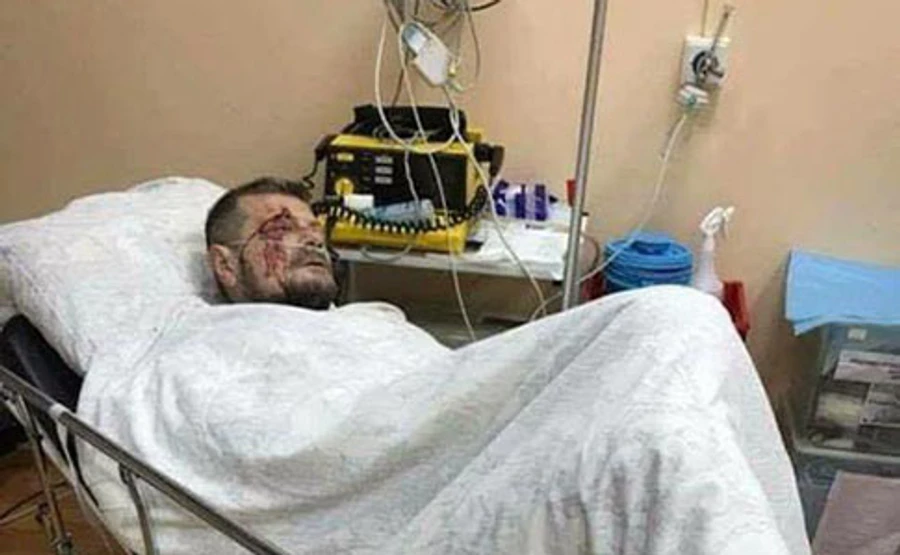 Мосійчук у замаху на себе звинувачує Росію