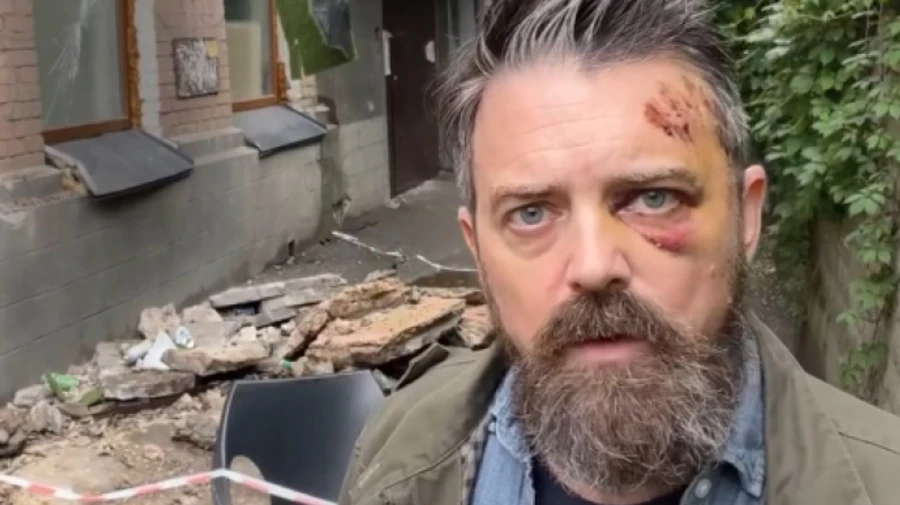 Под американским журналистом в Киеве обрушился балкон