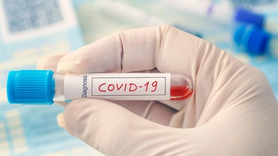 Греция будет требовать ПЦР-тесты у прилетающих из Румынии и Болгарии