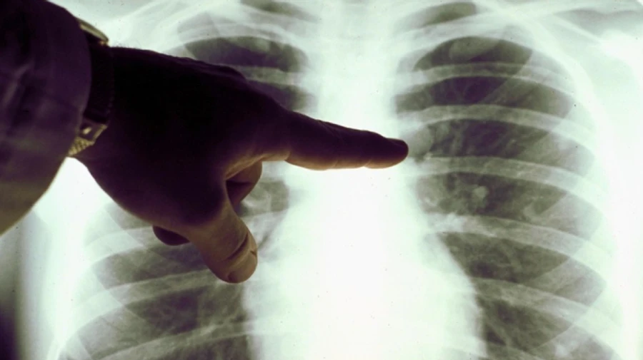 Держстат відмовився давати дані про смертність українців під час карантину - Опендатабот