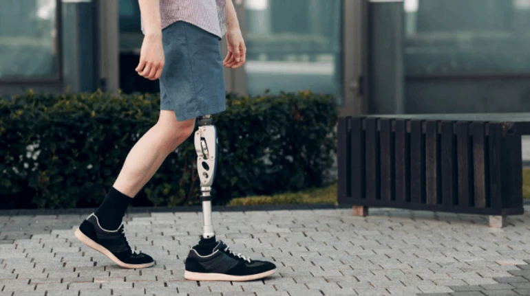 Не можна опиратись лише на бажання пацієнта. Що таке остеоінтеграційне протезування та які його ризики