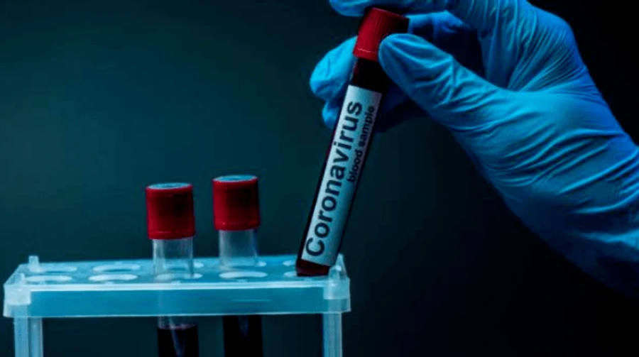 COVID-19: Больше всего новых больных — в США