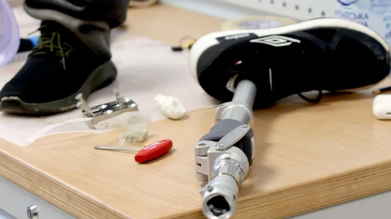 Перші кроки пацієнта – моральна надбавка до зарплати. Протезисти про роботу та навчання в Україні