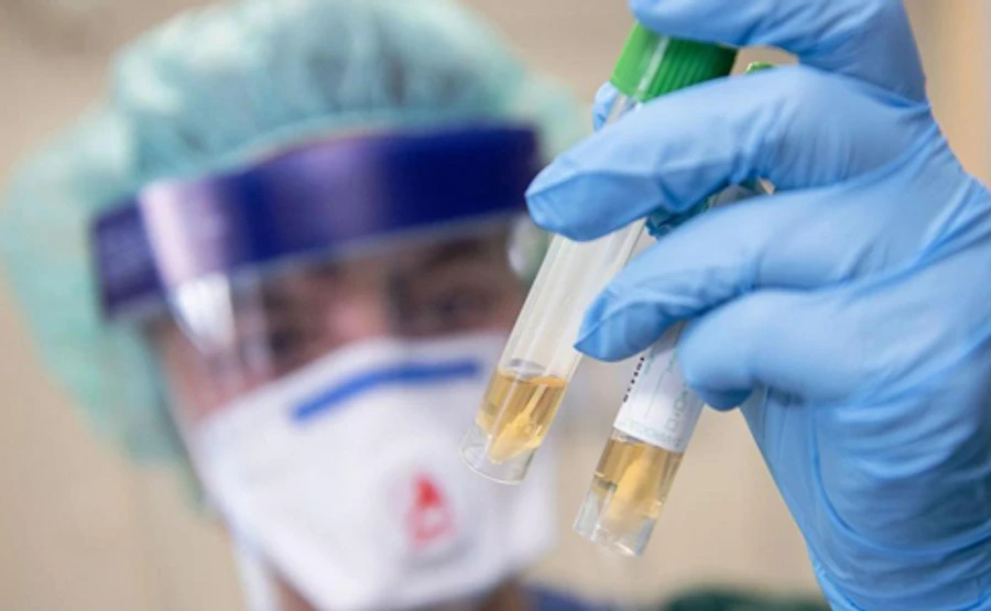 Кожен третій, інфікований COVID-19 на Сумщині, не має симптомів