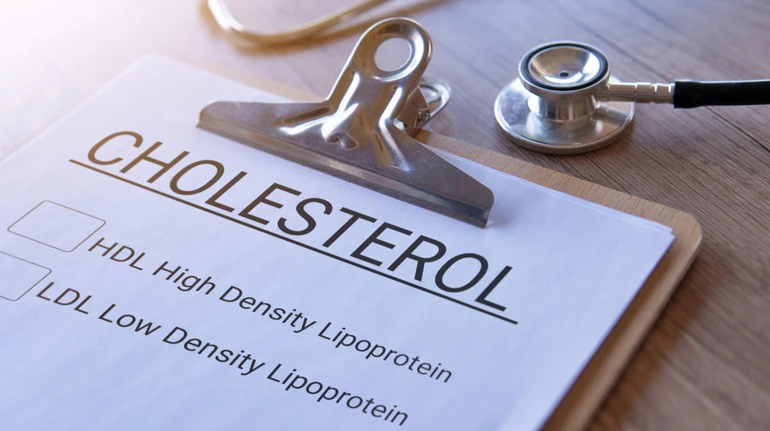 Нижчі норми і рання діагностика: в США змінили рекомендації щодо контролю за рівнем холестерину