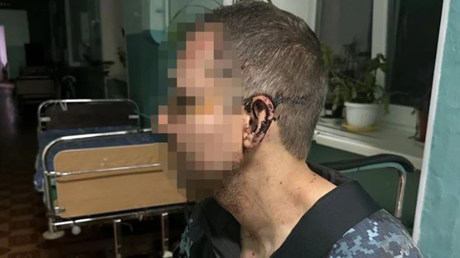 В одній з військових частин на Одещині побили військового