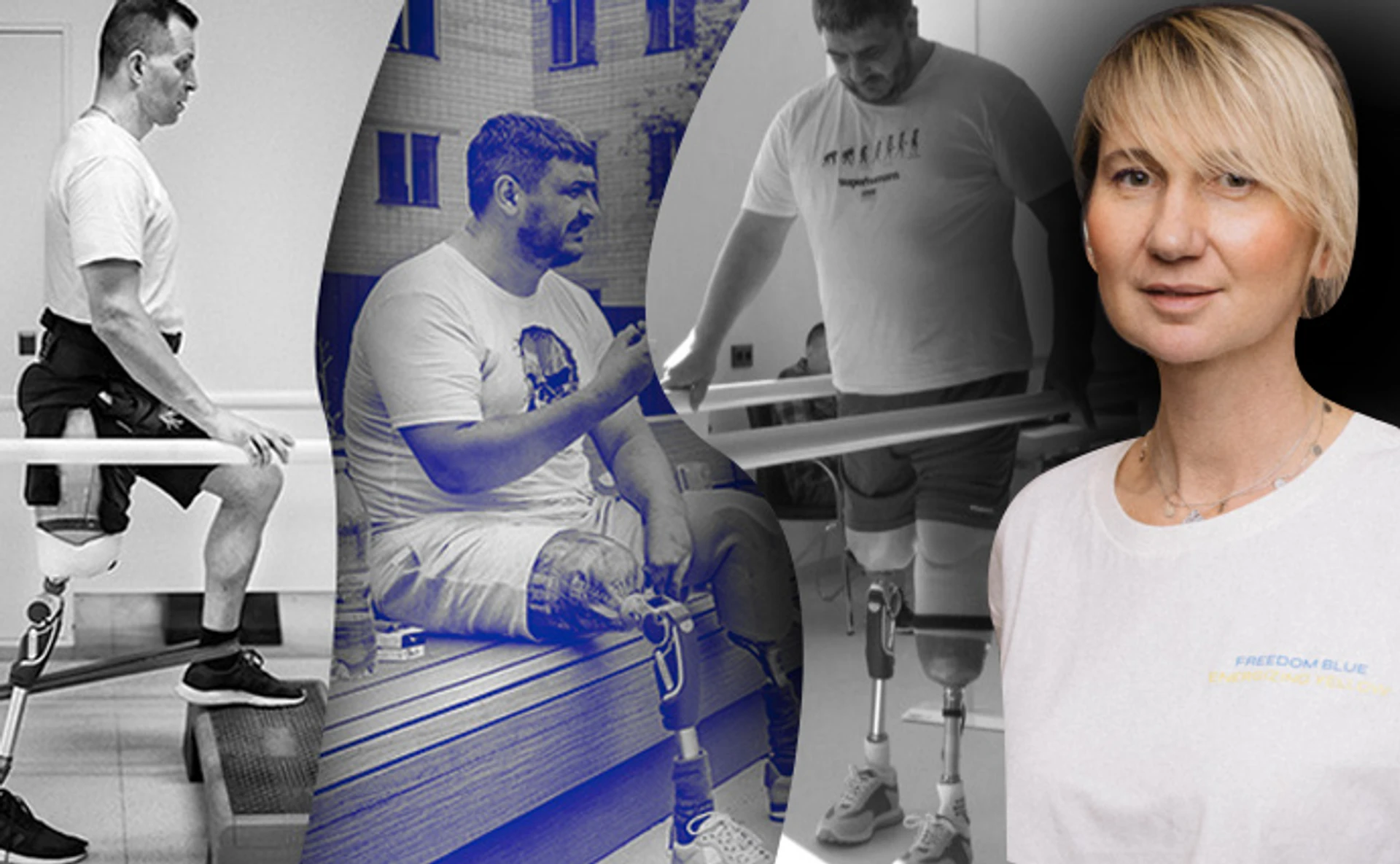 Более 20 тысяч украинцев нуждаются в протезах. Сколько они стоят и где их брать?