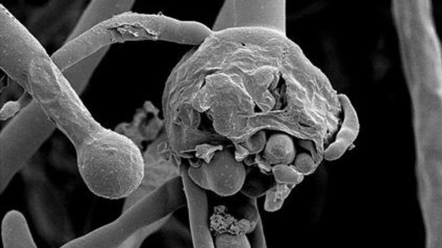 В Індії люди, що перехворіли на COVID-19, почали інфікуватися рідкісним “чорним грибком”