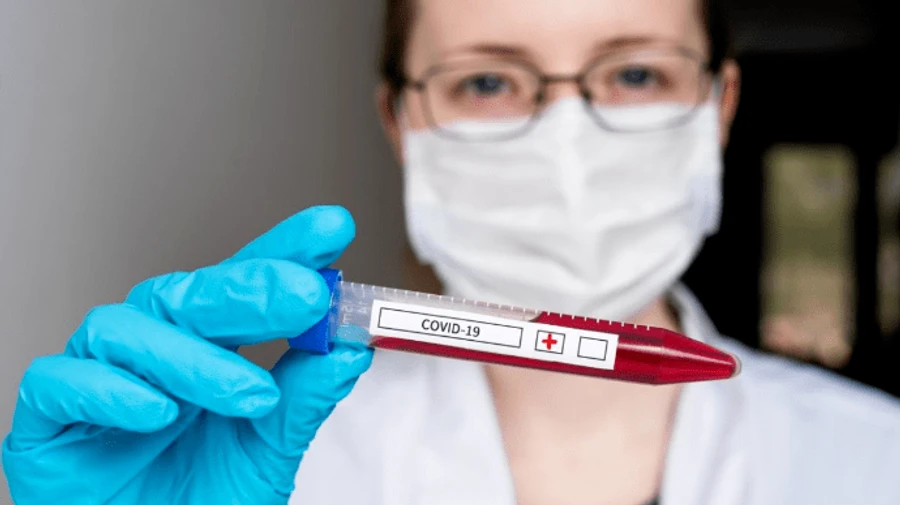 COVID-19: Україна опинилася на 8 місці у світі