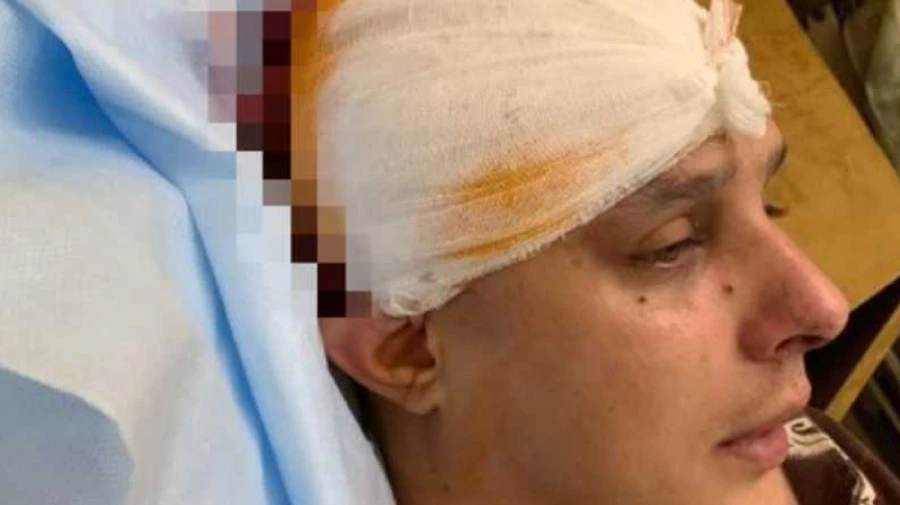 Продюсер группы KAZKA был жестоко избит: нападавшего задержали по горячим следам