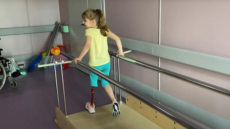 Parents imagined a leg where the toes would move. How Ukraine's first child who lost a limb due to the war is undergoing prosthetics treatment