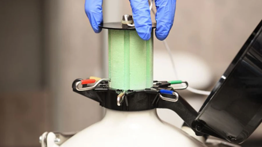 Рада підтримала перше читання: захисники безоплатно зберігатимуть репродуктивні клітини у кріобанках