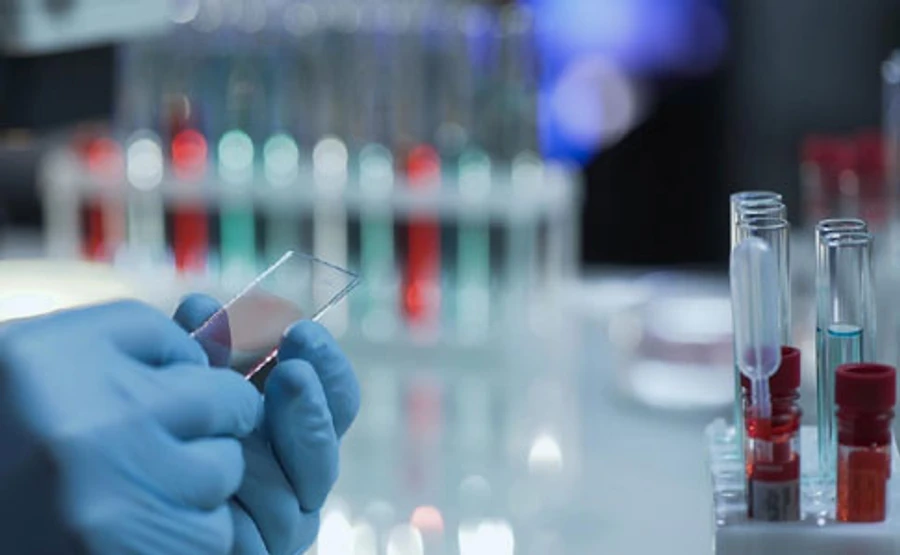 В Італії за добу виявили 2313 нових хворих