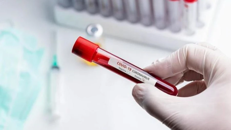 На праздники киевляне меньше делали тесты на коронавирус - Кличко