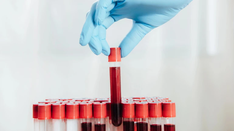 Анализ крови на 50 видов рака не доказал эффективности - масштабное исследование