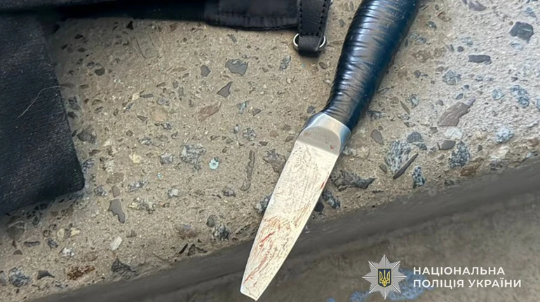 Уламок ножа залишився в голові: у Тернополі школярка напала на однокласницю