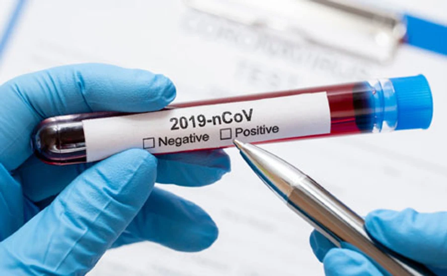 На Чернігівщині перший випадок інфікування Covіd-19