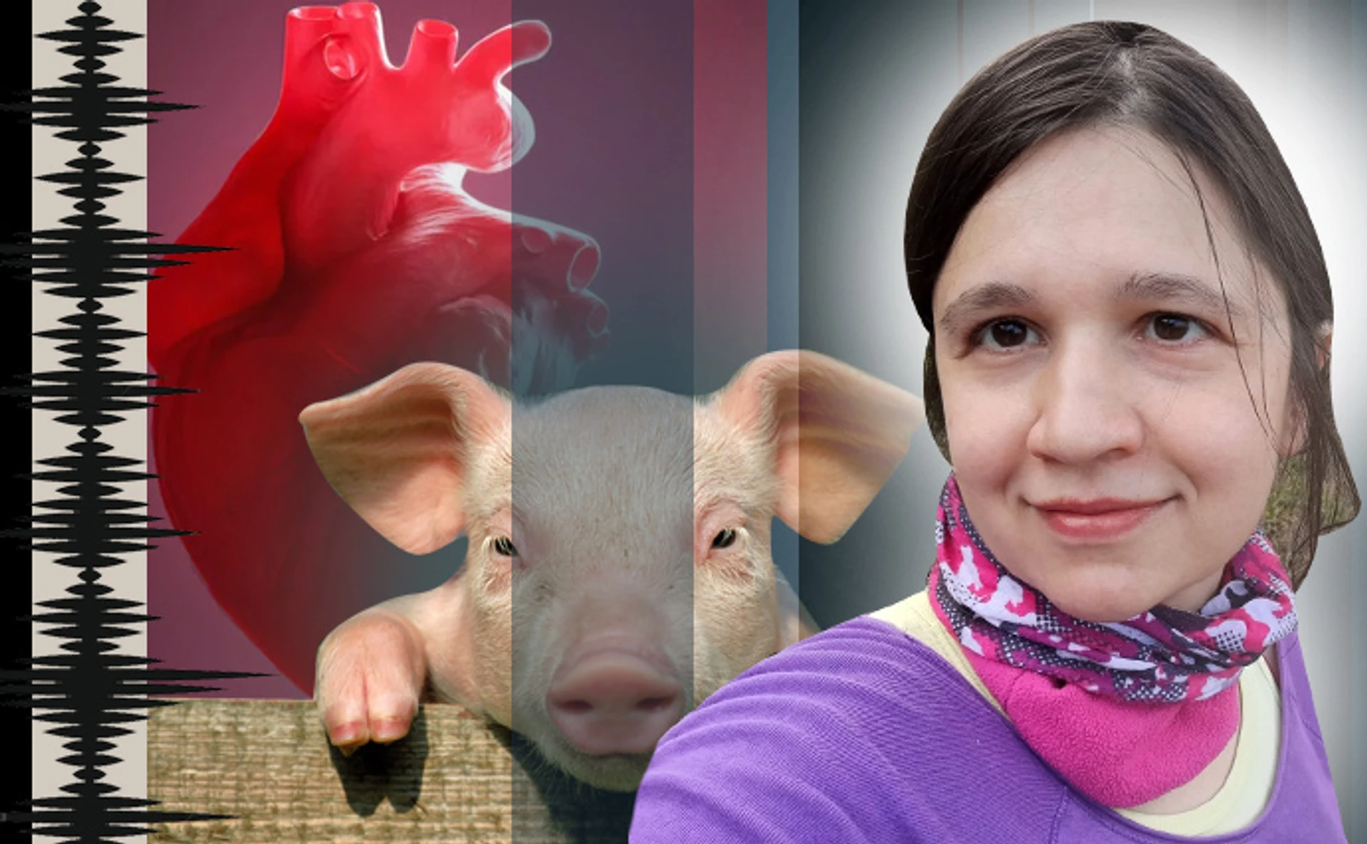 Свиняче серце, людське тіло. Чи вирішує ксенотрансплантація проблему нестачі органів для пересадки?