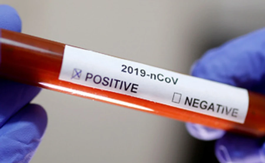 Первая смерть от коронавируса в Европе: во Франции умер турист из Китая 