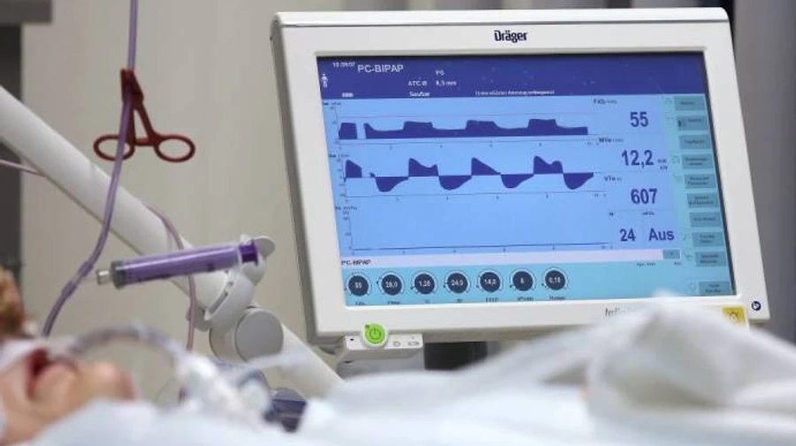 СБУ: в киевских больницах разворовали 2 миллиона гривен на аппаратах ИВЛ