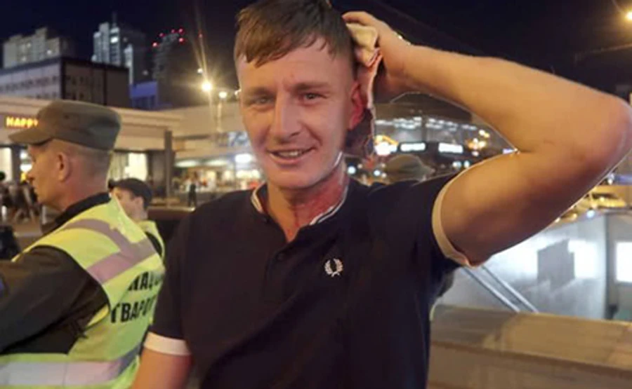 Драку с фанами Ливерпуля в Киеве квалифицировали как хулиганство