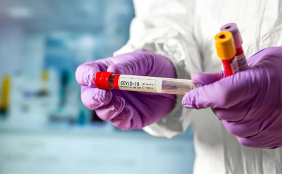 На Рівненщині виявлено 49 нових випадків коронавірусу, в роботі лабораторій залишається 394 зразки