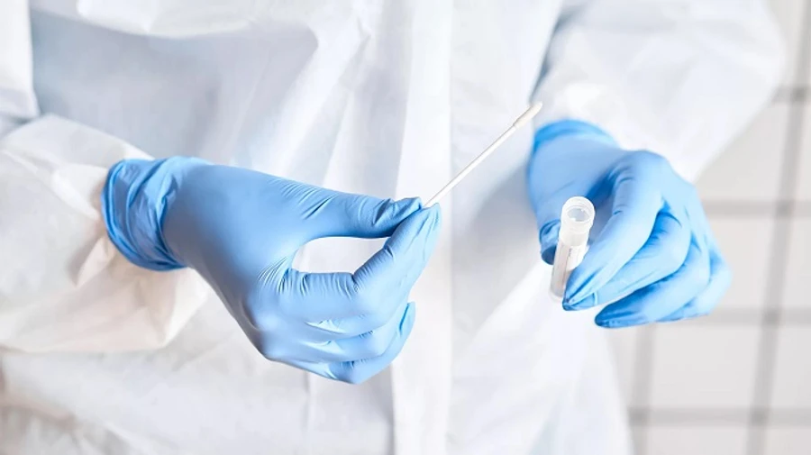 На диагностику коронавируса Кабмин выделил 150 млн гривен