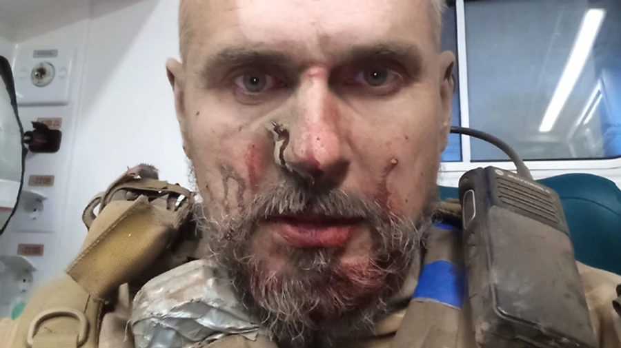 Сенцов потрапив під обстріл на фронті