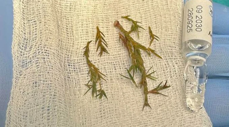 Наслідки могли бути фатальними: у Львові врятували хлопчика, який мало не задихнувся від гілок ялинки