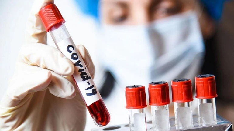 Украина в 10-ке лидеров в Европе по смертности от COVID