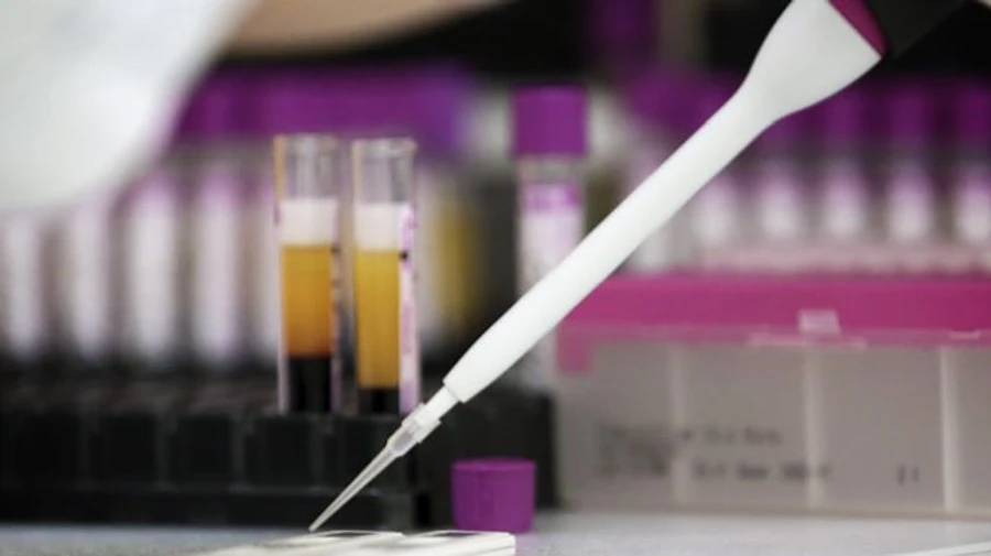 В России – антирекорд смертей COVID-19 и снова увеличился прирост заболевших