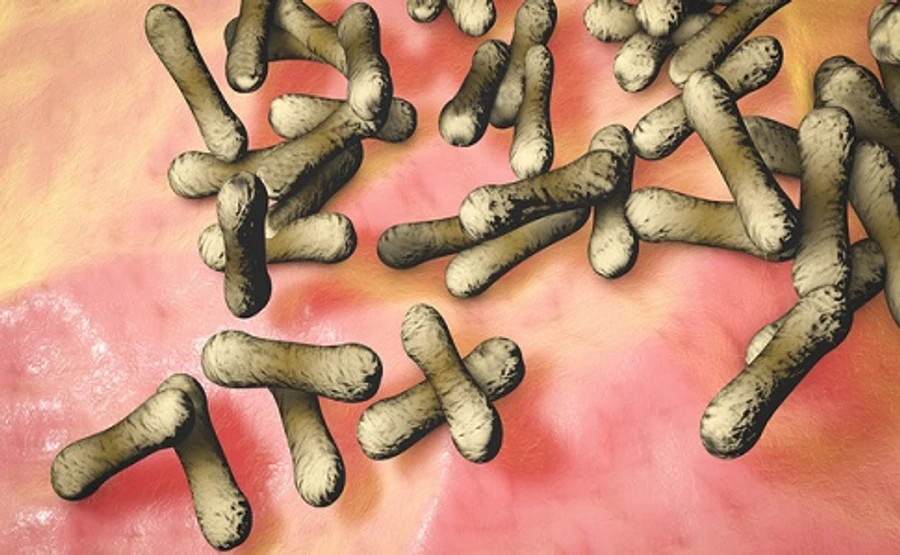 У Києві підтвердили випадок захворювання на дифтерію