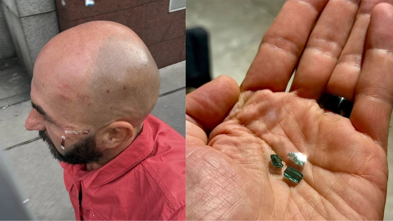 Three shards of glass under his eye and espionage charges: how a UP employee was kept handcuffed in an Austria