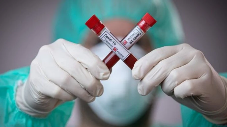 Епідемія: Степанов каже, що третині госпіталізованих ще не підтвердили діагноз