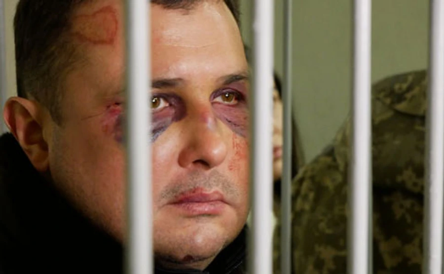 Шепелеву сломали не только челюсть: появились новые детали задержания