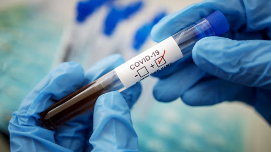 Греція безкоштовно роздаватиме набори для тестування на COVID-19