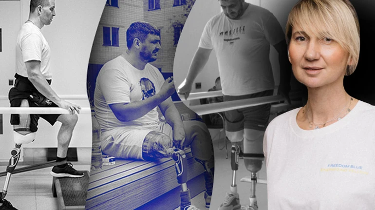 Понад 20 тисяч українців потребують протезів. Скільки вони коштують та де їх брати?