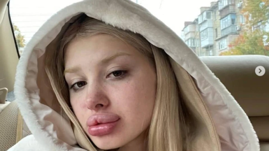 Скандальная блогерша стала участницей ДТП: опубликовала видео, как они сбивают человека