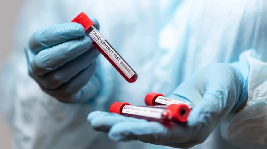 На Закарпатті підозрюють ще 6 випадків штаму Delta: люди були в Росії