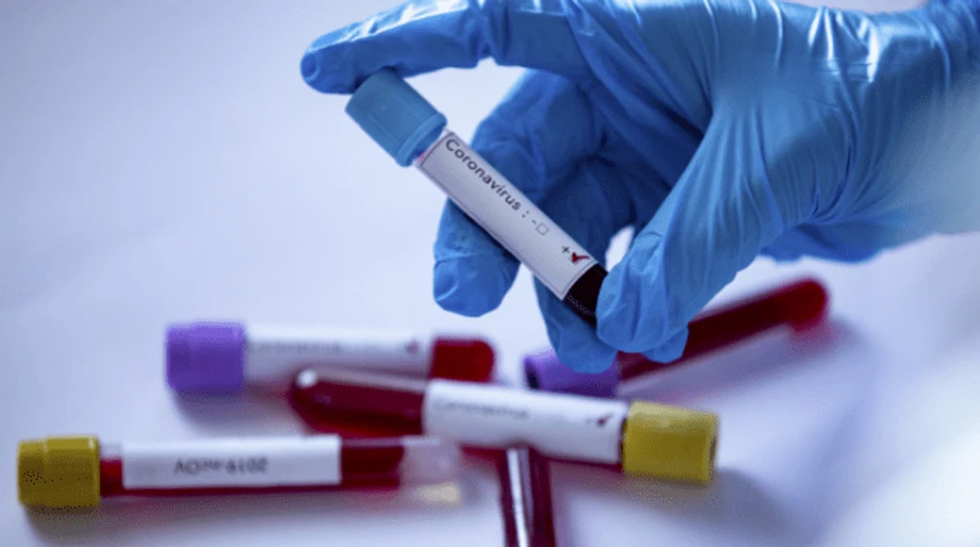 COVID: Более 500 тысяч случаев в мире, больше всего в США и Турции