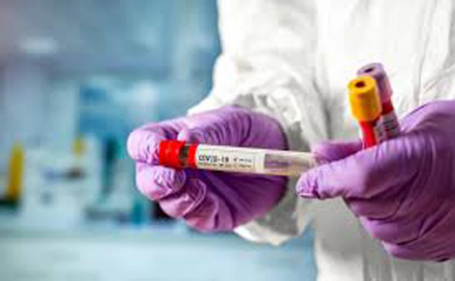 От COVID-19 умер водитель скорой на Волыни