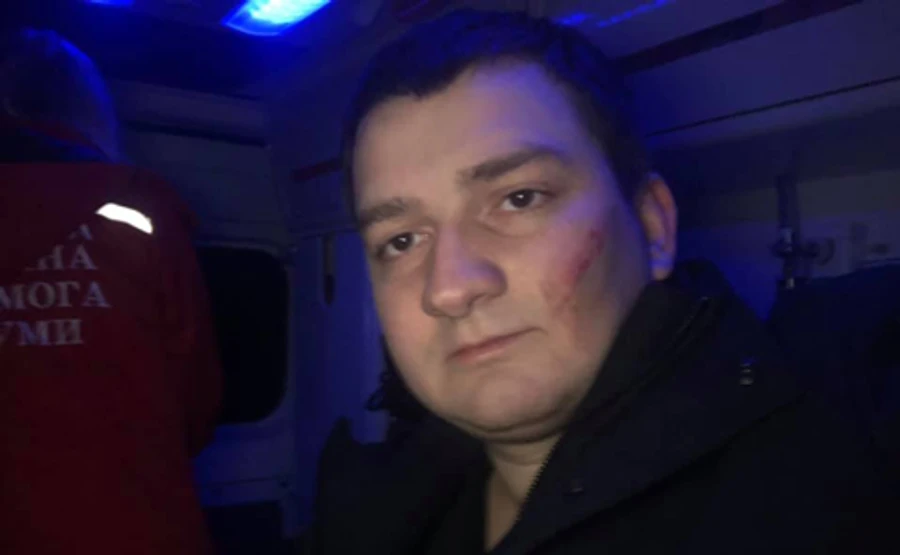 На нардепа от Слуги народа напали неизвестные