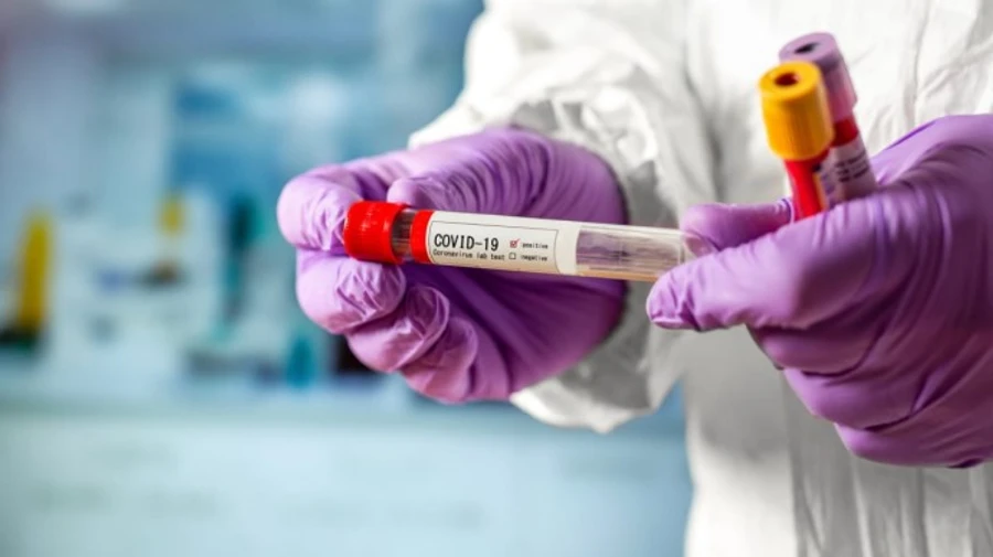 Кількість заражень коронавірусом у світі наближається до 20 мільйонів