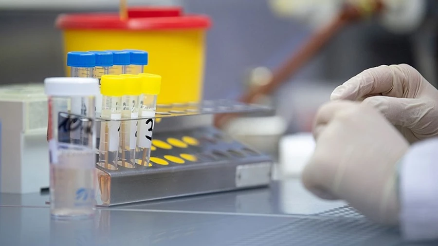 В мировом рейтинге Украина опустилась на 38 место по распространению COVID