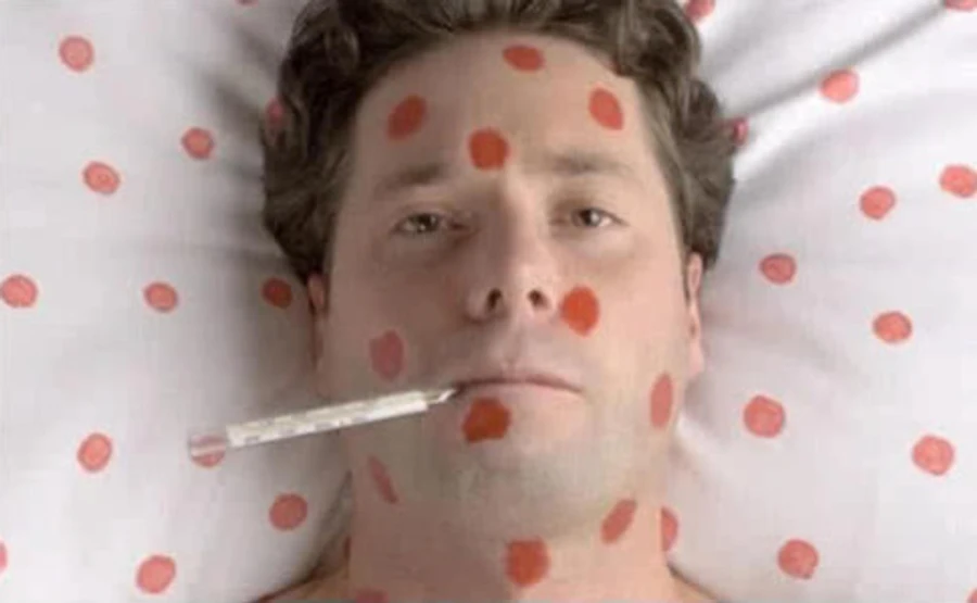 За неделю корью заболели более 500 человек - Минздрав