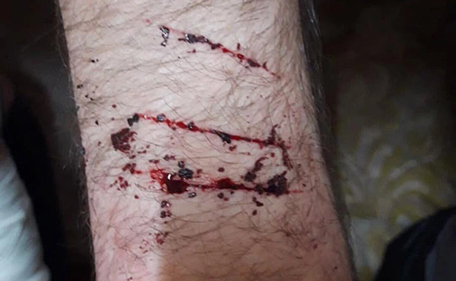 У Чернівецькому СІЗО стався бунт через в'язня з COVID-19, є постраждалі