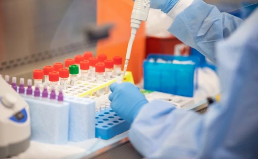 ОП: Украина будет производить тысячи ПЦР-тестов ежедневно