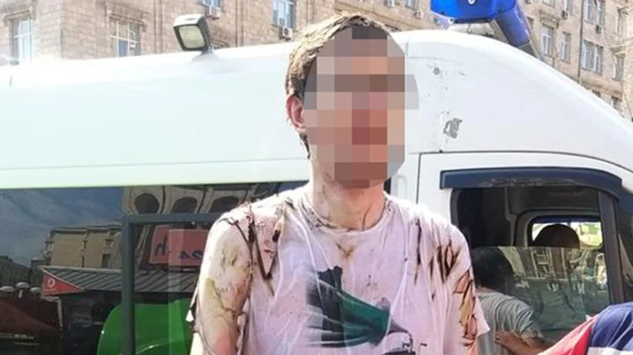 Во время торжеств в центре Киева мужчина поджег себя