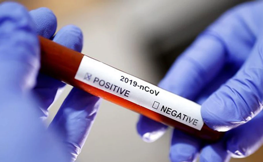 Минздрав закупил тесты на коронавирус для более 90 000 человек