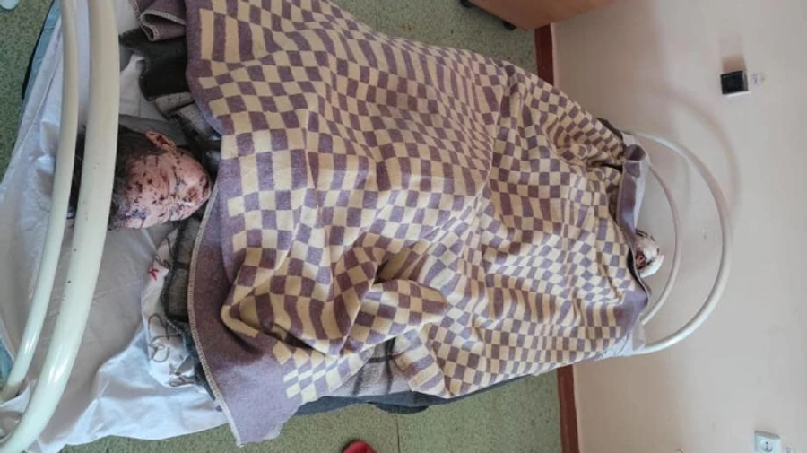 Shelling of Sievierodonetsk: two twin children injured, the enemy hit the hospital